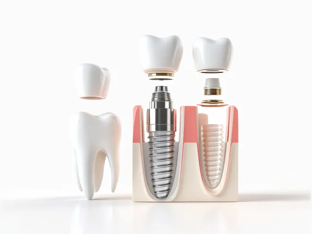 รากฟันเทียมคืออะไร? ทางเลือกใหม่ที่ลดความยุ่งยากในการถอดใส่ฟันปลอม