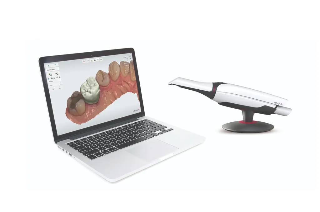 เครื่องสแกนช่องปากดิจิทัล นวัตกรรมเพื่อความสวยงามและรวดเร็ว