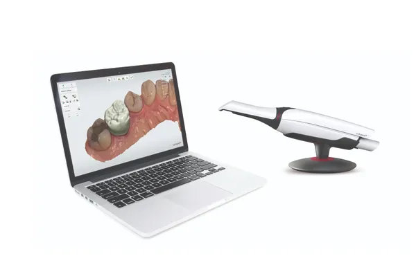 เครื่องสแกนช่องปากดิจิทัล นวัตกรรมเพื่อความสวยงามและรวดเร็ว